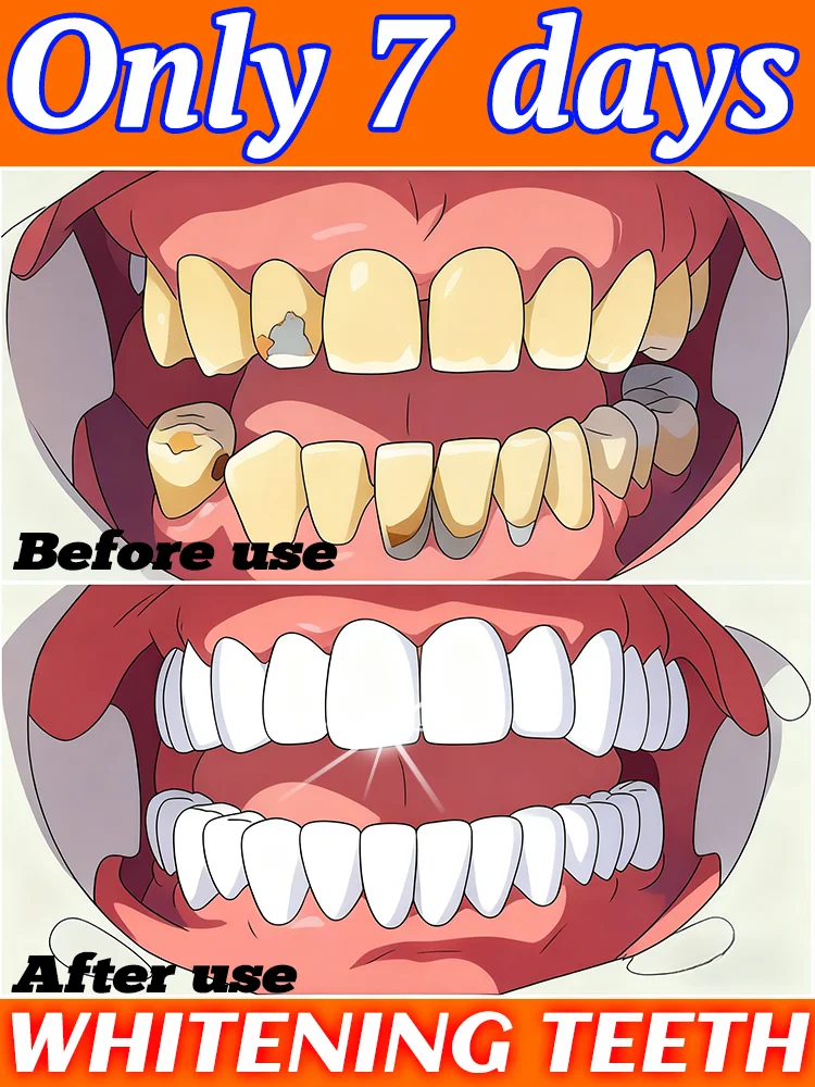 The best-selling product cleans your mouth, prevents tooth decay, and helps you regain your confidence