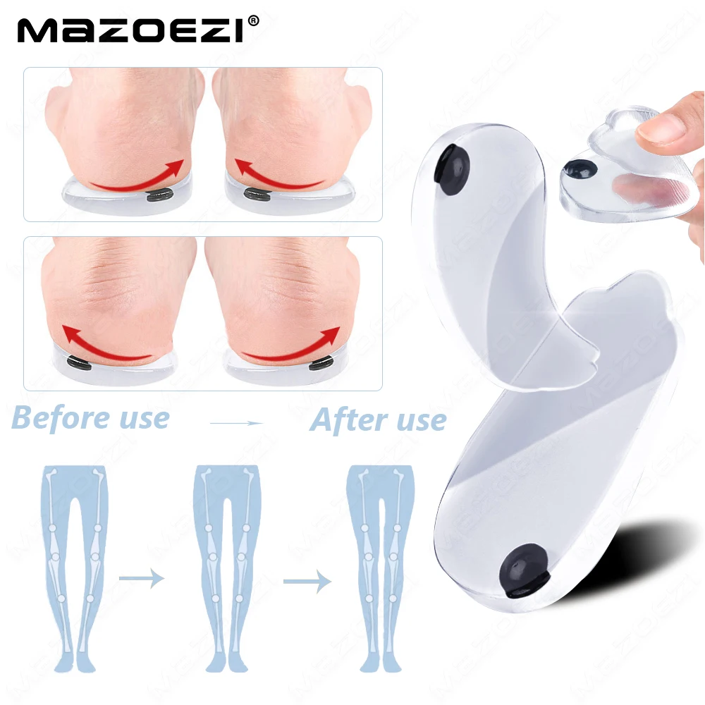 MAZOEZI Gel Orthopedic Insoles for Feet O X Leg Type Valgus 