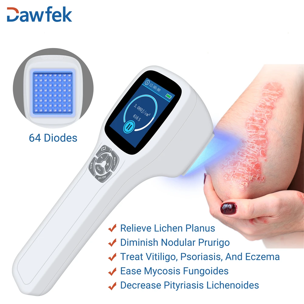 Dawfek 308nm Excimer Light Treatment Handheld Anti Vitiligo Psoriasis, Home UVB Light Therapy Device for Skin Disorder