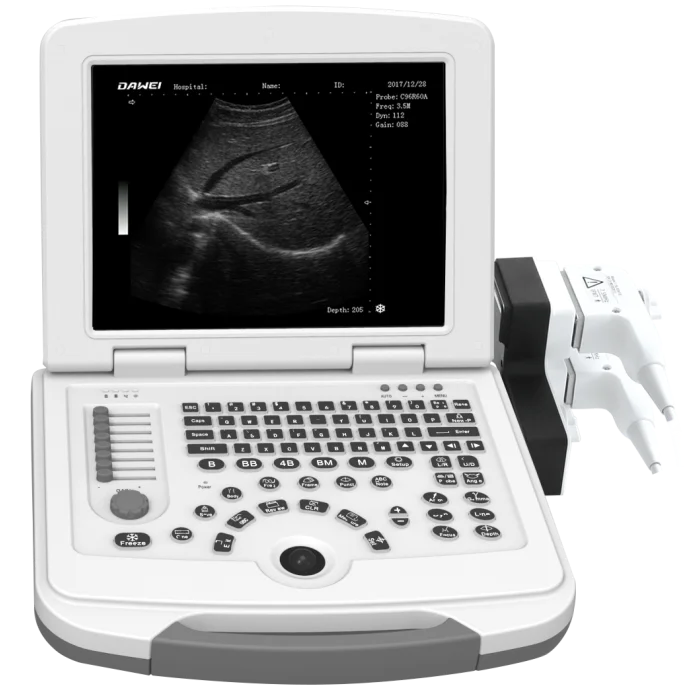 

DaWei DW-580 Doppler Ultrasound Keymed Diagnostic Apparatus Laptop Machine