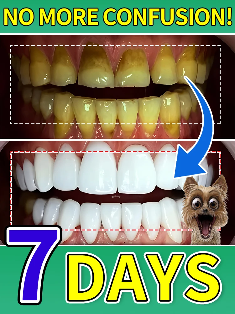 

Dental care, removal of stains, stones, fresh breath，Teeth Bleaching Breath Freshener Polish Yellow Stain Remover Brighten