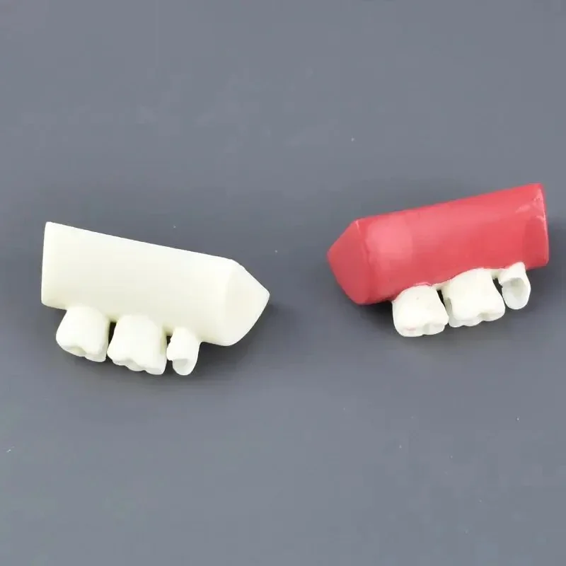 

1PCS Dental Inlay Exercise Model Block Filling Exercise Typodont Resin Materials Oral Filling Model For Dentistry Teaching Stud