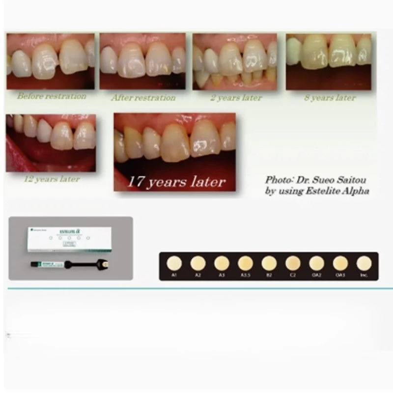Dental Materials UV Curable Nano Resin ESTELITE Restoration Anterior Posterior Tooth Defects Wear-resistant Toughness Laboratory