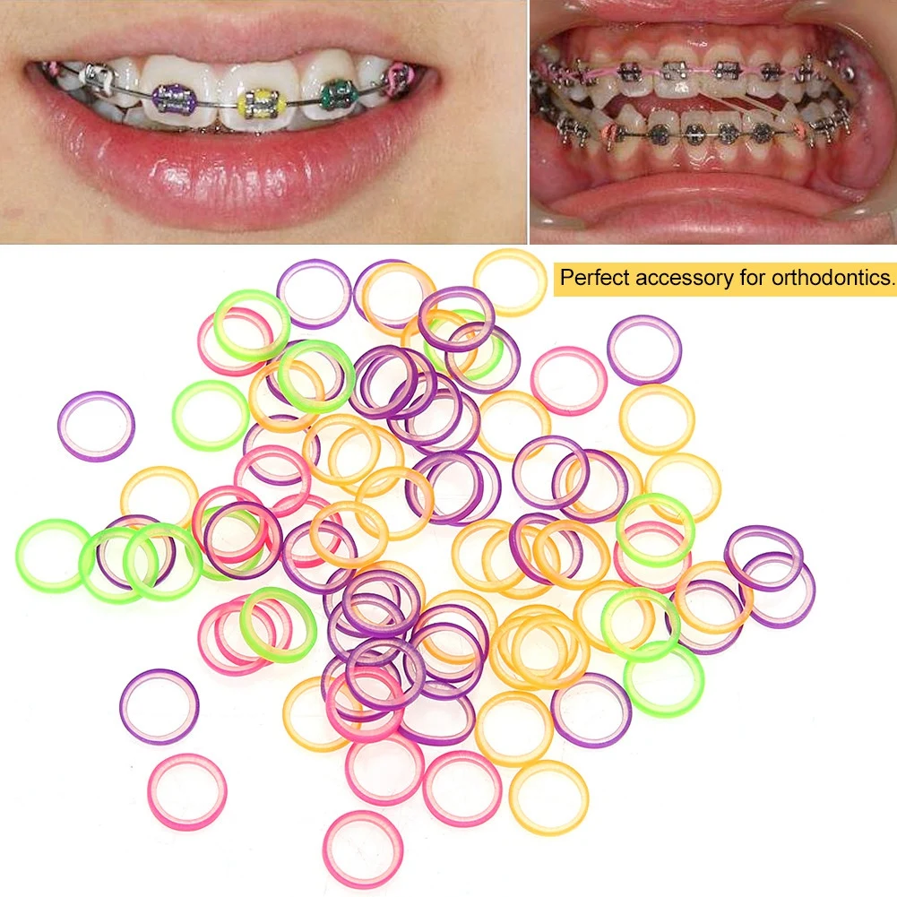 300 Pcs Elastic Rubber Teeth Traction Rings Orthodontics Rubber Band Mixed Dentist Tools Dentistry Accessories Dental Laboratory