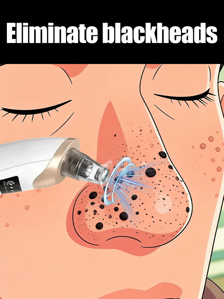 2025 New Upgrade Nose blackhead remover pimples and blackheads vacuum from the face cleaner Tool