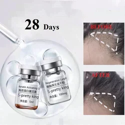 Stem Cell Hair Growth Serum Anti Hair Loss 28 Days Fast Grow Prevent Thinning  Hair Care Essence Hair Growth Essential Oil