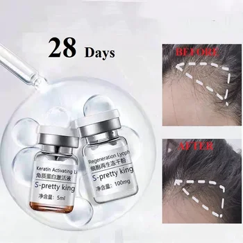 Stem Cell Hair Growth Serum, Anti Hair Loss, 28 Dias Fast Grow, Impedir o cuidado do cabelo diluindo, Óleo essencial