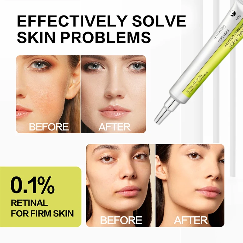 Retinol Eye Cream Essence Set Panthenol 1% Lightens Dark Circles Fine Lines Firms Skin Vitamin C Moisturizing Eye Cream Essence
