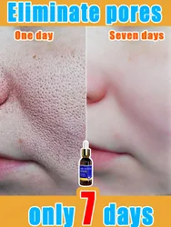 pores remover pore shrinking serum shrink Tightening Minimizing