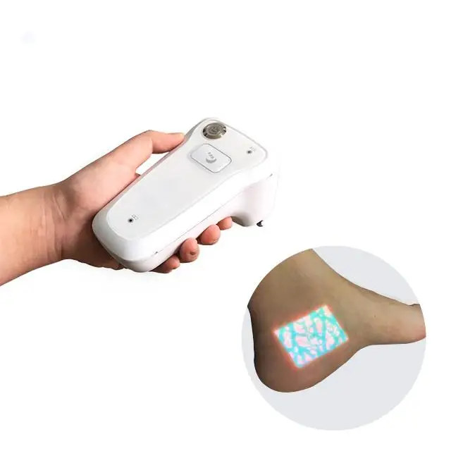 

Portable Infrared Vein Finder Vein Displayer vein finder for face Vascular imaging instrument