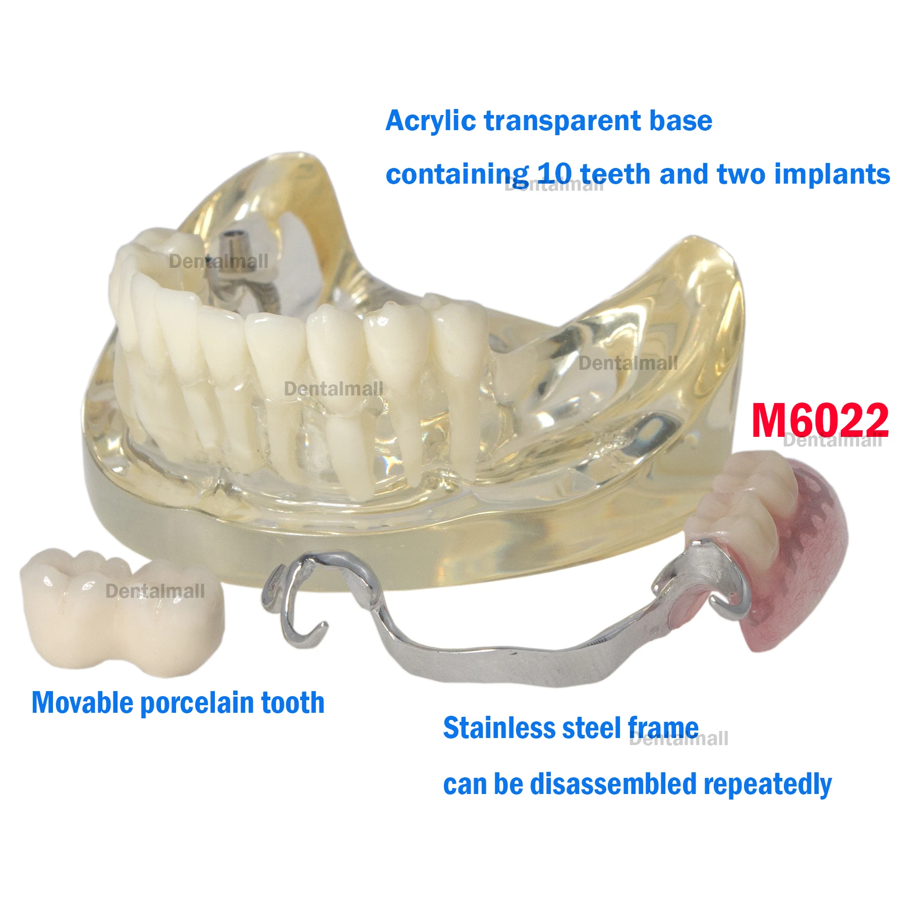 Dental Typodont Implant and Restpration Teeth Model with Partial Denture M6022