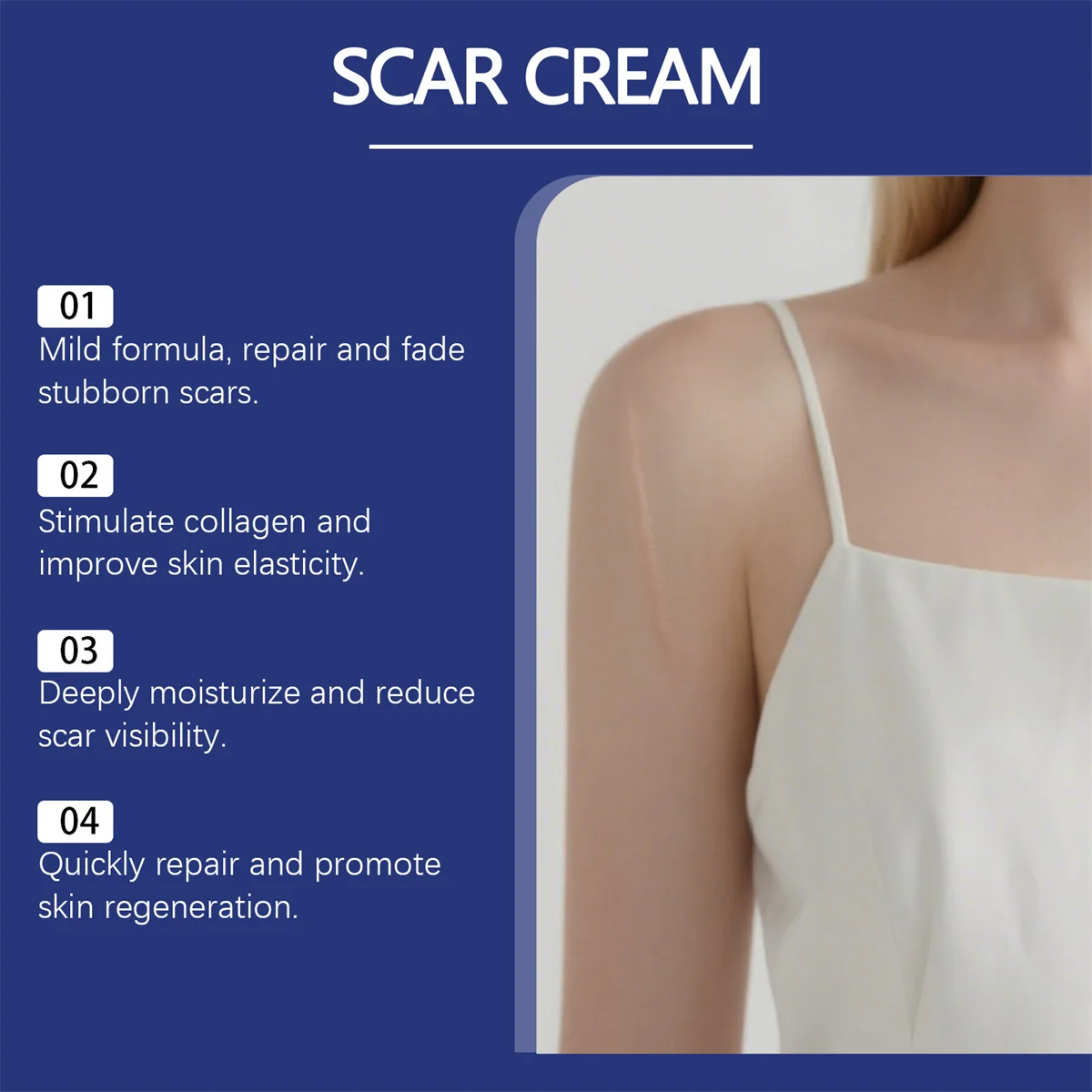 كريم العناية بالبشرة يغذي البشرة بلطف ويلاشى الندبات القديمة والجديدة وتحسن جودة البشرة #2