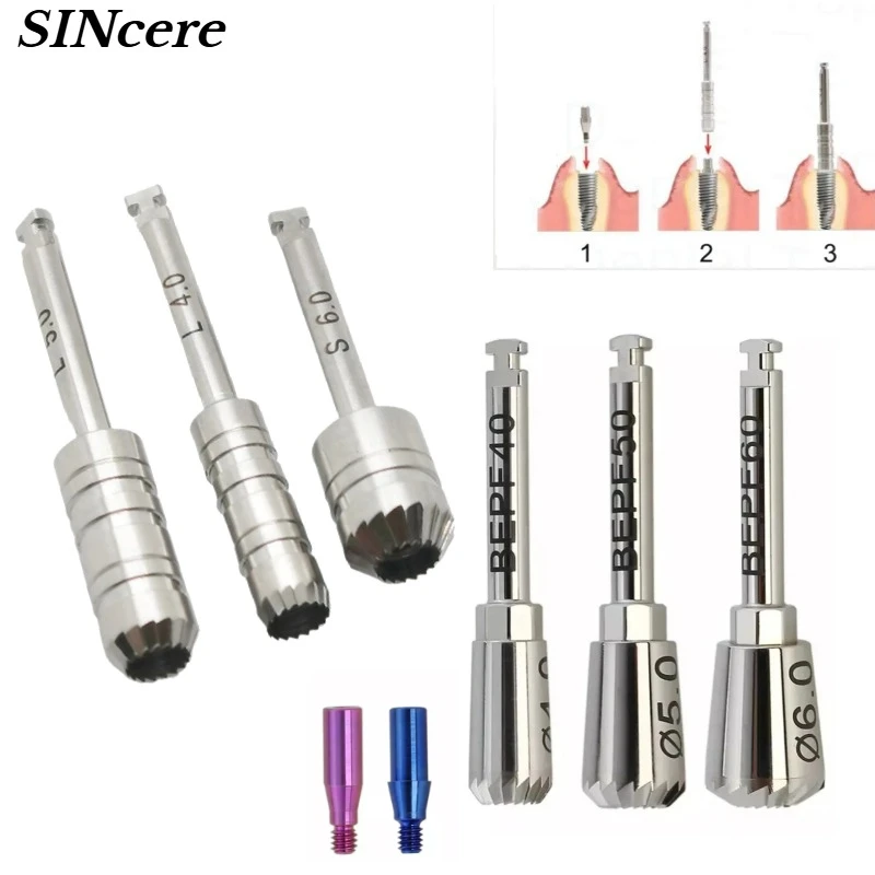 Dental Implant Bone Profiler Guide Screw Surgical Instrument Bone Grinding Oral Implant Peripheral Bone Fit for OSSTEM Hiossen