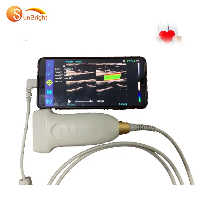 

Smart phone Android 128 Elements 4-16 Mhz Linear ultrasound wireless probe