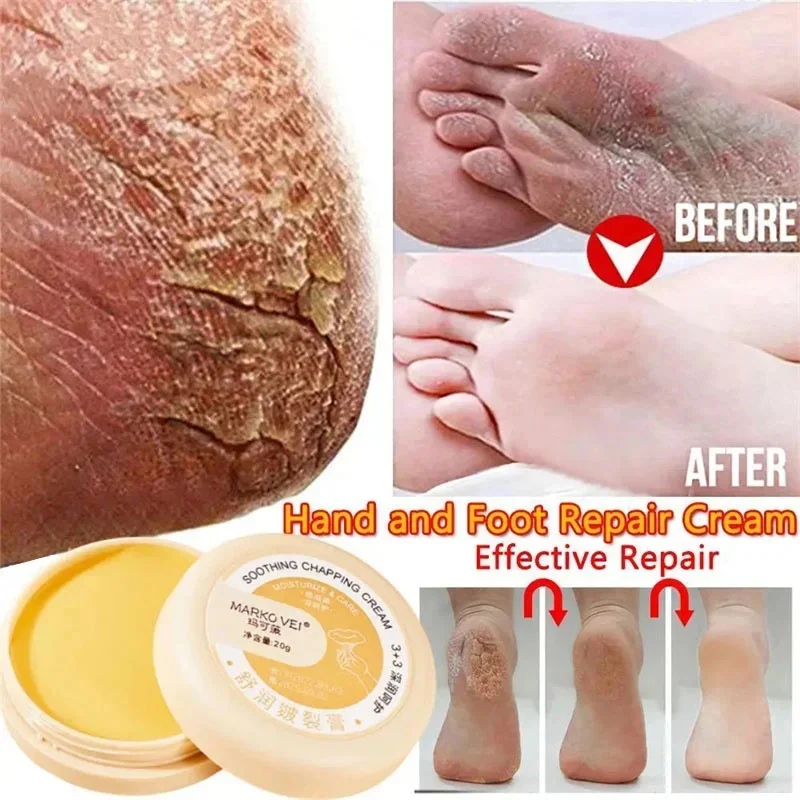 

Anti Drying Cracking Foot Cream Heel Cracked Repair Oil Removal Calluses Dead Skin Anti Chapping Moisturize Hand Foot Skin Care