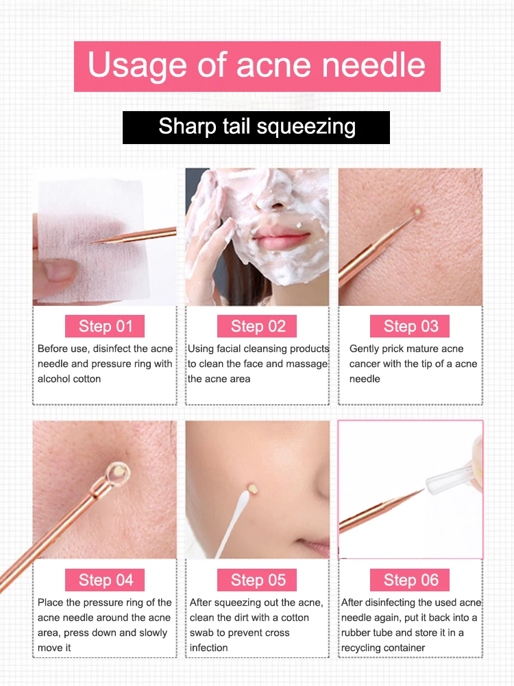 Comedondrukker Puistje Comedo Extractor Tool Beste Acne Verwijdering Kit Behandeling voor Smet Whitehead Popping Zit Verwijderen voor