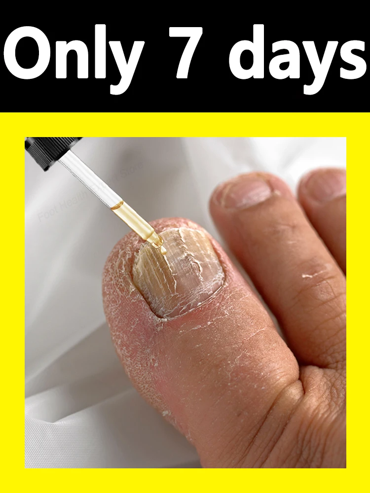 7日間でマニキュアを手に入れよう