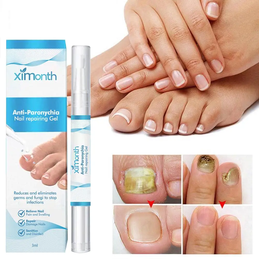 Caneta indolor do reparo do prego, Serum do reparo das unhas dos pés, Anti cuidado para mais grosso quebrado, N9F7 descolorido