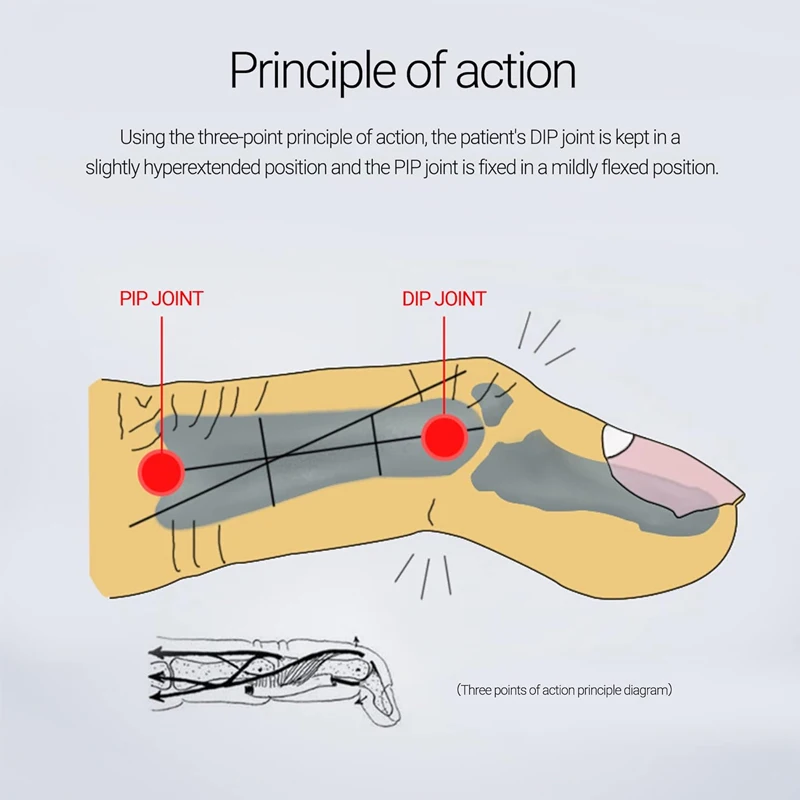 HENGPIN Silicone Finger Protectors Moisturizing Pain Relief Finger Sleeves Thickened Anti-Slip Guards for Writing Cooking Work