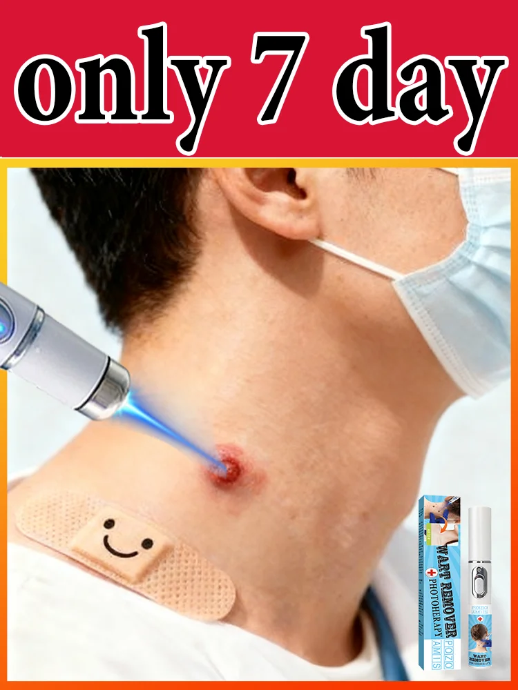 

Gᴇɴᴇʀᴀᴛɪᴏɴ-3 Lᴀsᴇʀ Sᴀʏs Gᴏᴏᴅʙʏᴇ Tᴏ Wᴀʀᴛs Iɴ 7 Dᴀʏs