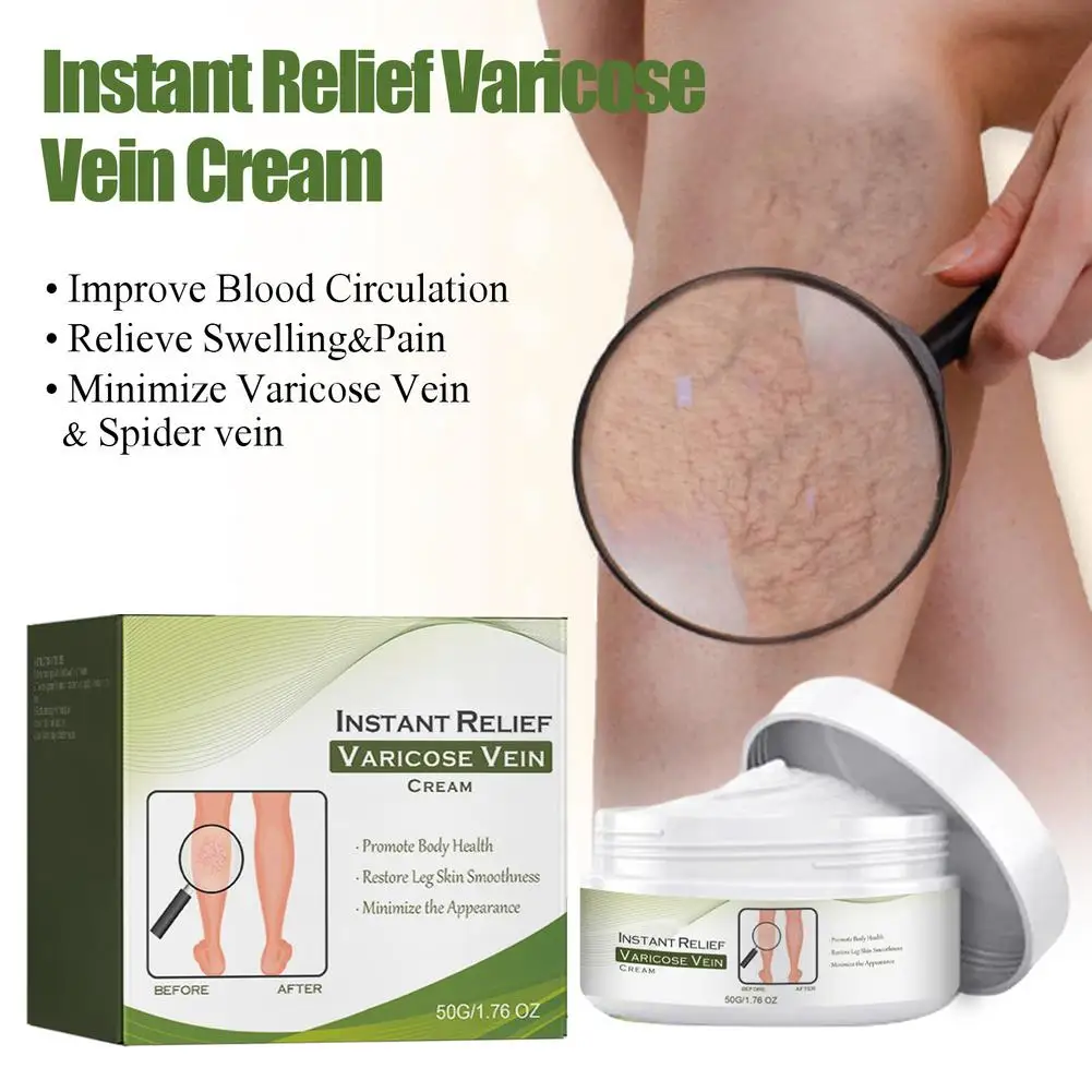 Crema reparadora de venas varicosas Tongmai, 50g, eficaz, alivia el dolor en las piernas, crema para tratamiento del dolor, vasculitis, flebitis, crema reparadora de venas