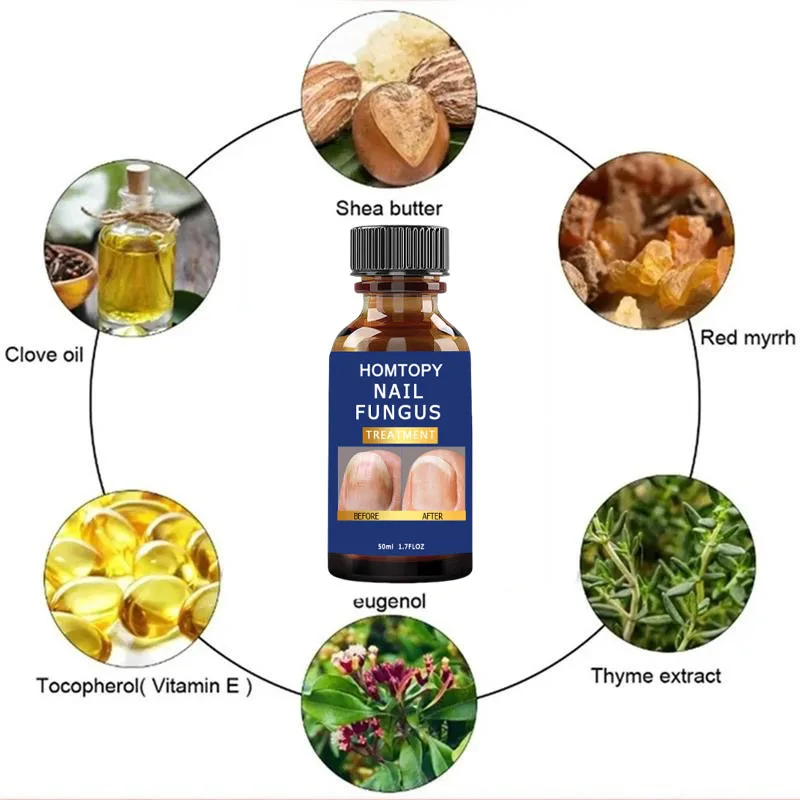 เซรั่มรักษาเชื้อราเล็บเท้า กำจัดเชื้อราที่เล็บนิ้วเท้า น้ำมันหอมระเหยป้องกันการติดเชื้อโรค โรคเล็บอักเสบ โรคเล็บอักเสบชนิดอักเสบบริเวณเล็บ บำรุงและฟื้นฟู