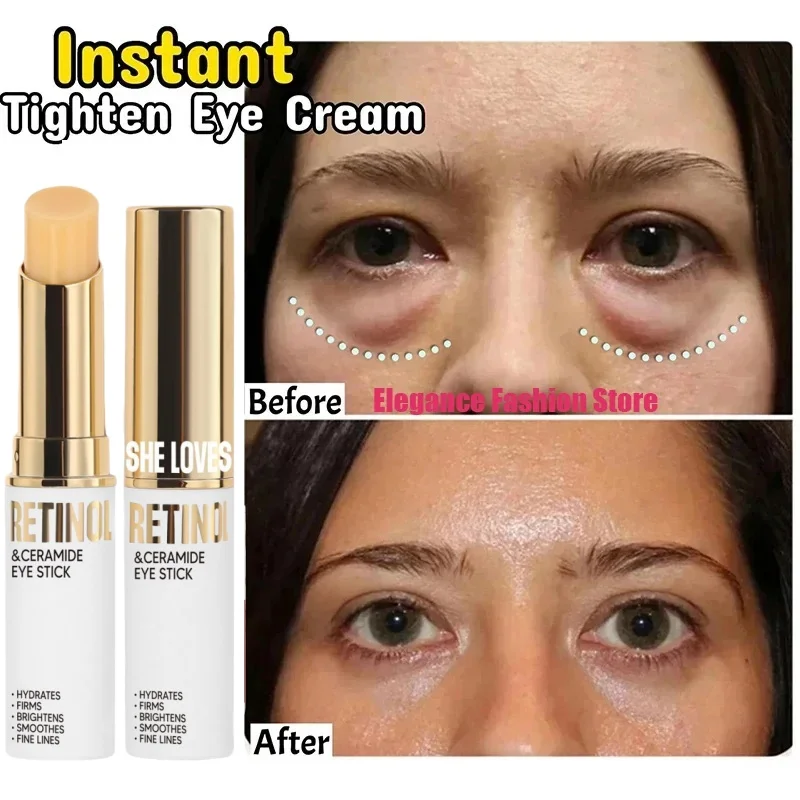 

Instant Eye Bag Remove Eye Cream Anti Fat Particles Dark Circles Puffiness Fade Fine Lines Lift Brighten Korean Beauty Eye Care