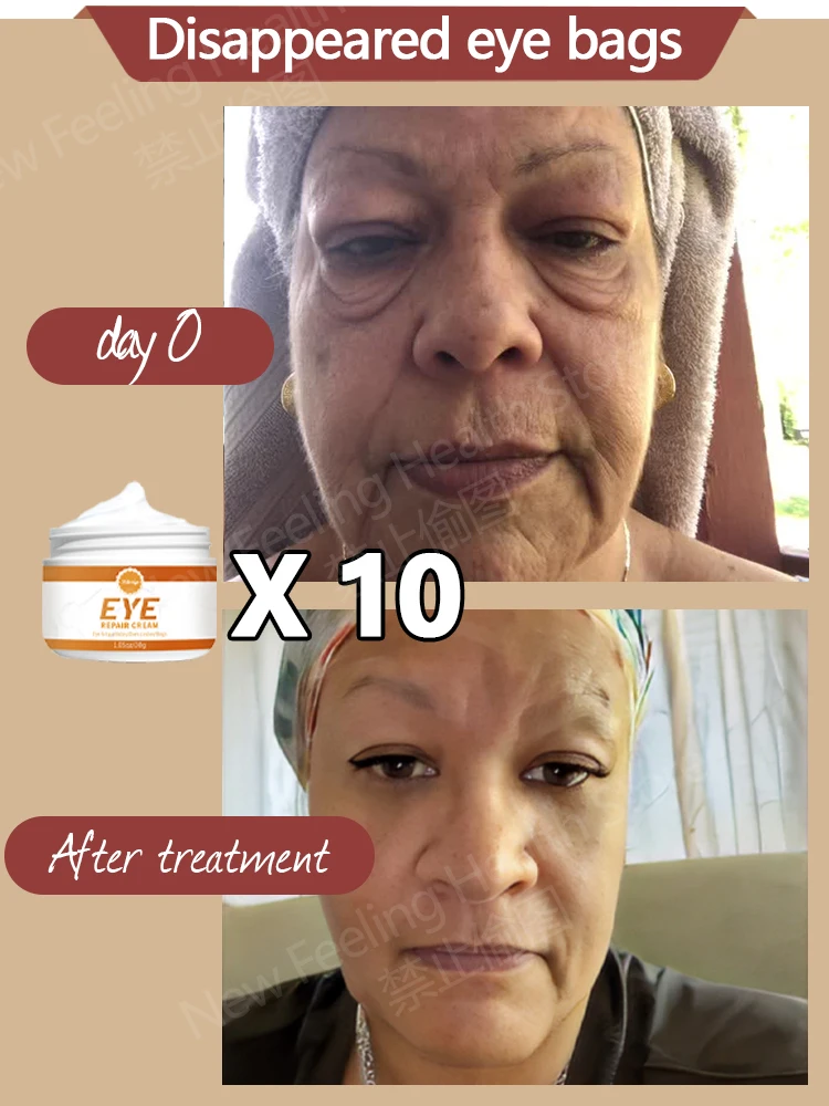 Remova sacos e Puffiness afastado o creme do olho, trabalho sob os olhos