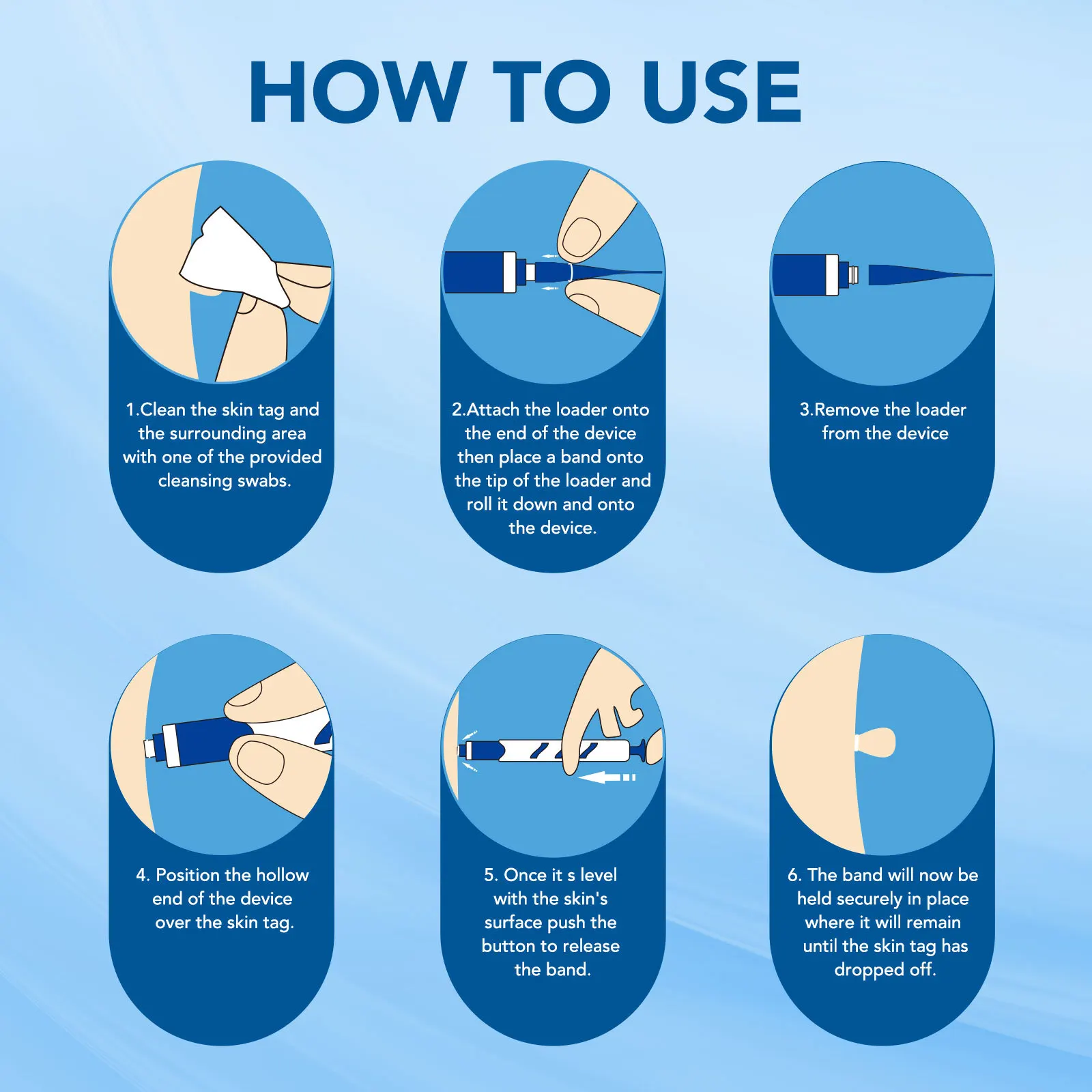 3 In1 غير مؤلم السيارات الجلد علامة الخلد الثآليل مجموعة إزالة أداة تنظيف الوجه العناية بالبشرة الجسم ثؤلول نقطة العلاج ل 1-4 مللي متر الجمال الصحة