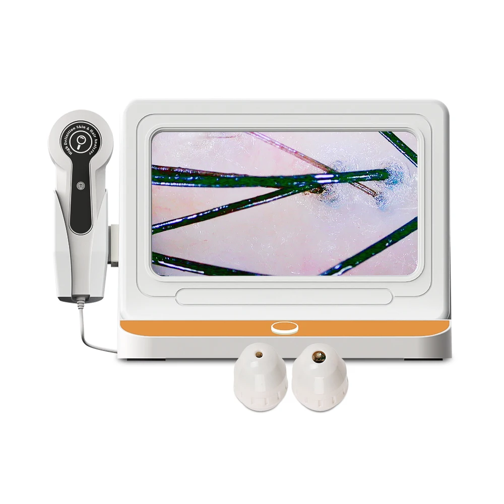 

Portable Hair Scalp Scanner / Scalp Hair Follicle Detector Analyzer / Scalp Analysis Machine