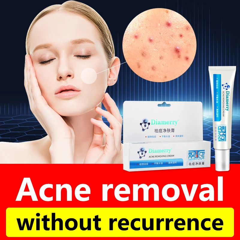 

Acne cream, eliminate blackheads and pimples, oil control, shrink pores, skin expert test, fast acne cream