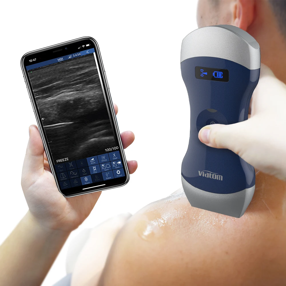 Viatom Probe Wireless Digital Ultrasound Scanner Portable Ultrasound Machine