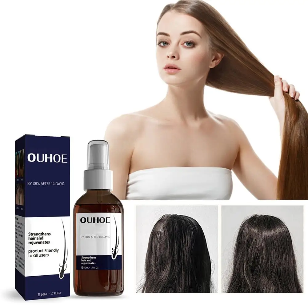 Productos en espray para hidratar el cuero cabelludo y fortalecer el crecimiento del cabello, aceites esenciales dañados para el cabello, M6Z9