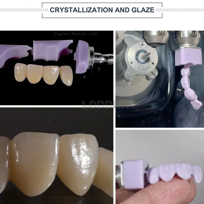 LODDEN-décennie s de disilication de lithium en verre céramique, C14 LT, anniversaire pour CAD, capture d\'écran, sièges Sirona CerSyste, matériel de