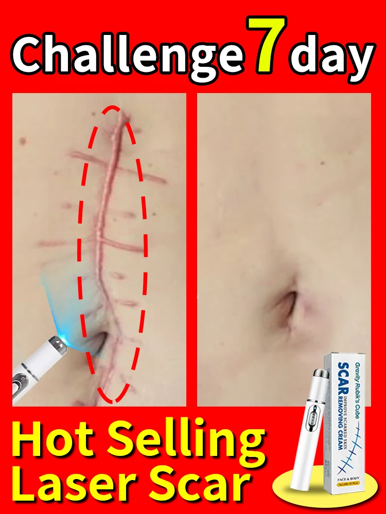 

Hot Selling Laser Repair Skin Scars.