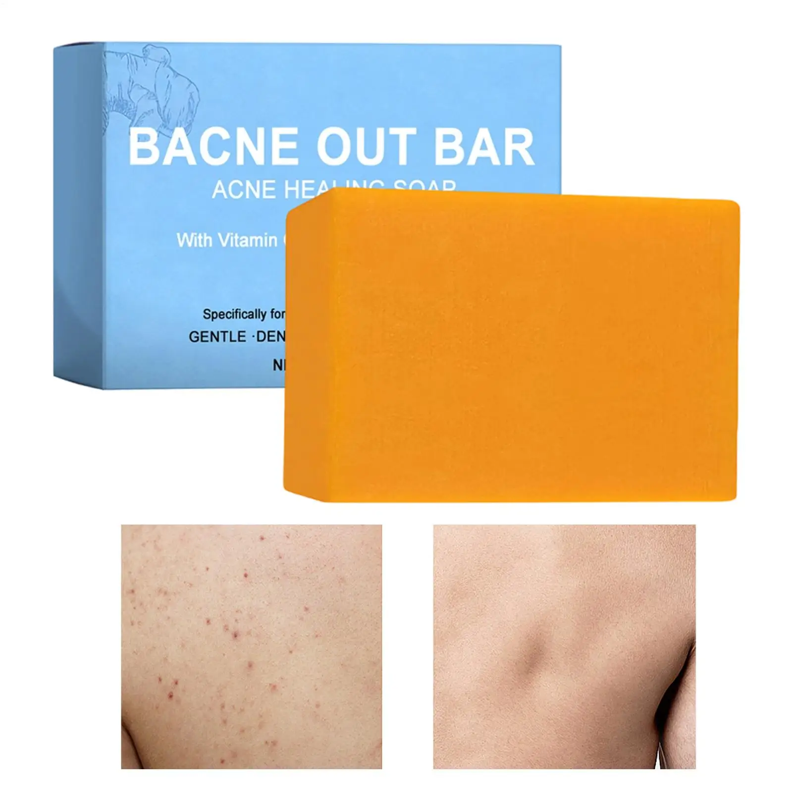 Body Cleansing Soap Gentle Anti Acne Exfoliating Facial & Body Cleanser Brightening Oil Control Soothing Skin Care Shower Soap