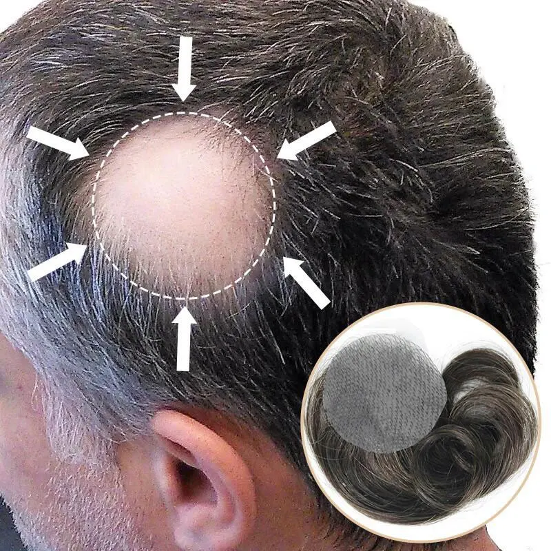 Thin Skin PU Bald Spot Hair Patches Toupee For Men 8CM X 8CM V-Looped Hair Piece Glue On Hair Replacement System For Bald Spot