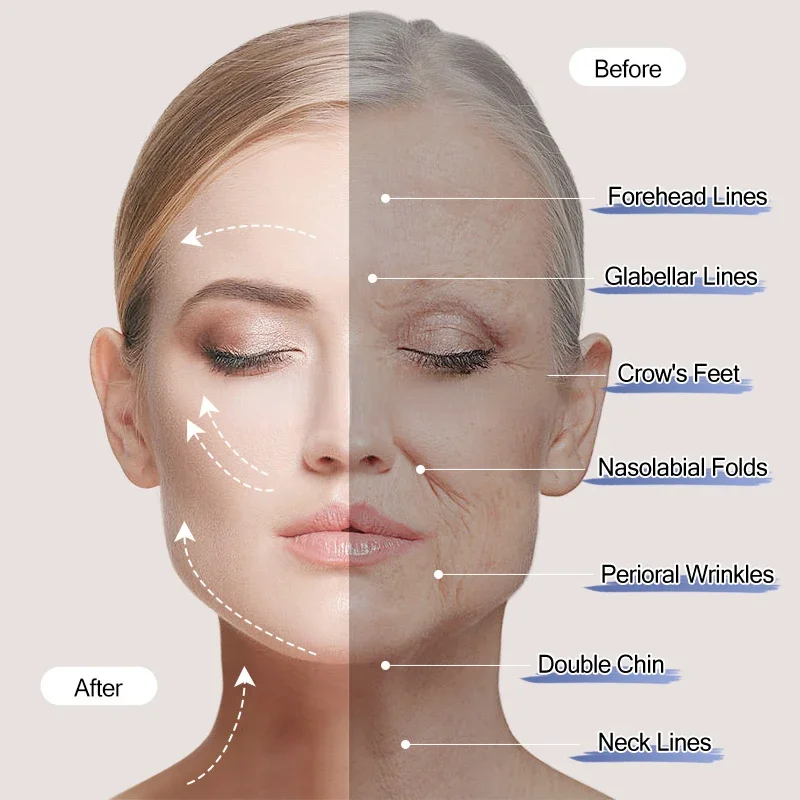 

Bestseller Facial Lifting And Wrinkle Removal Eye Lifting Eye Wrinkle Removal Anti-aging Beauty Care Massager