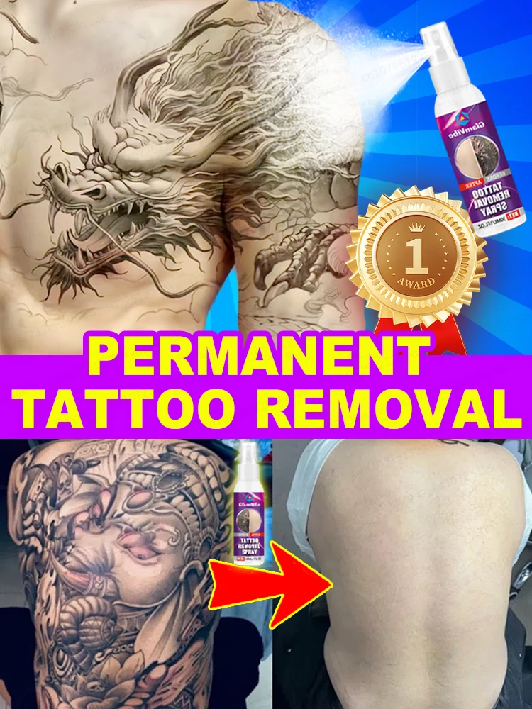 

Крем и спрей для удаления татуировок Best Sell