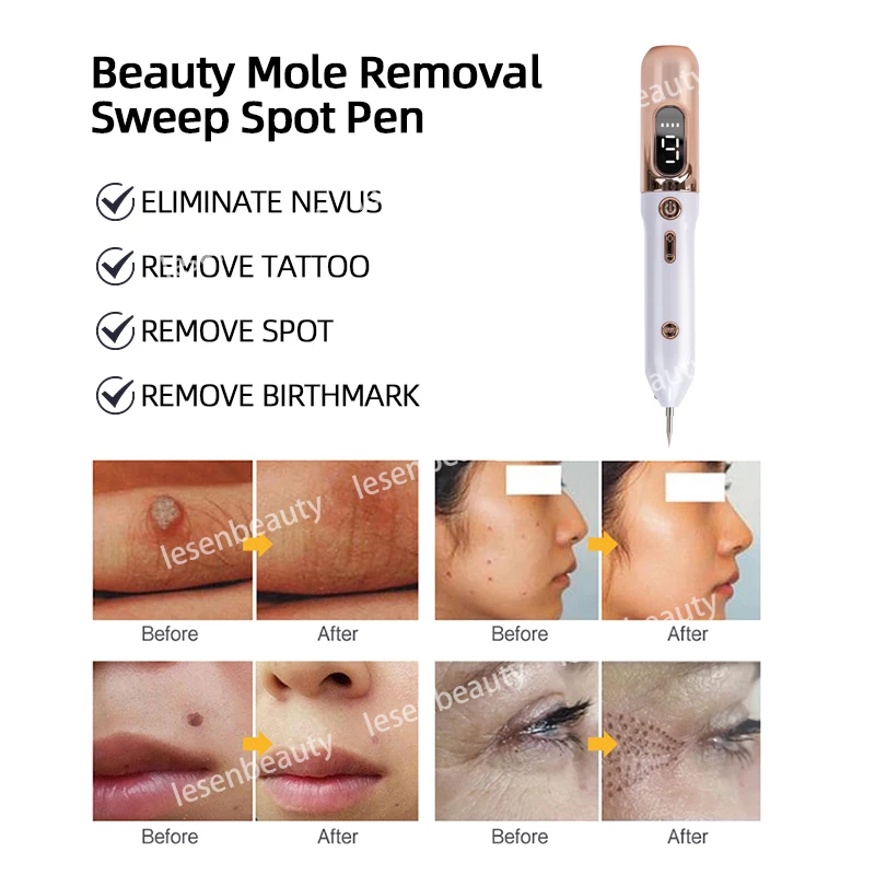 HOT SALE 9-Gear Mole Pen Blue Light Repair Electric Beauty Spot Salon Special Remove Fat Grain Warts USB Charging