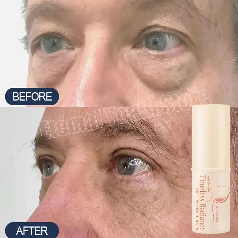 Saco de olho instantâneo remover creme de olho anti partículas gordas olheiras inchaço desbotar linhas finas levantar iluminar beleza coreana cuidados com os olhos