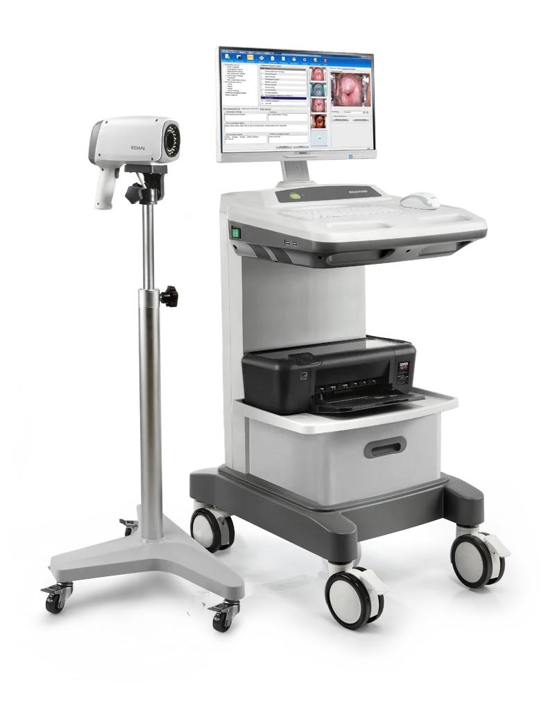 EDAN Video Digital Vaginal Imaging System Vaginal Examination Machine C3 with Rolling Stand