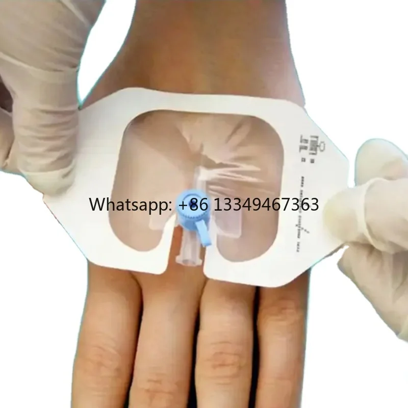 

In Stock Medical Disposable Breathable Transparent IV Cannula Fixed Hot Sale