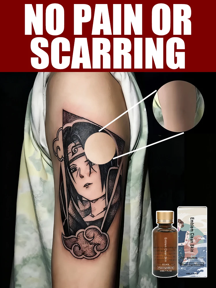 

Remove tattoos without leaving scars and lighten pigmentation