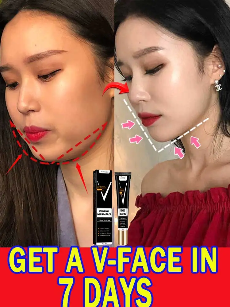 V Line Face Slimming Double Chin Eliminate Slimming the Face Face Slimming Cream Artifact Products