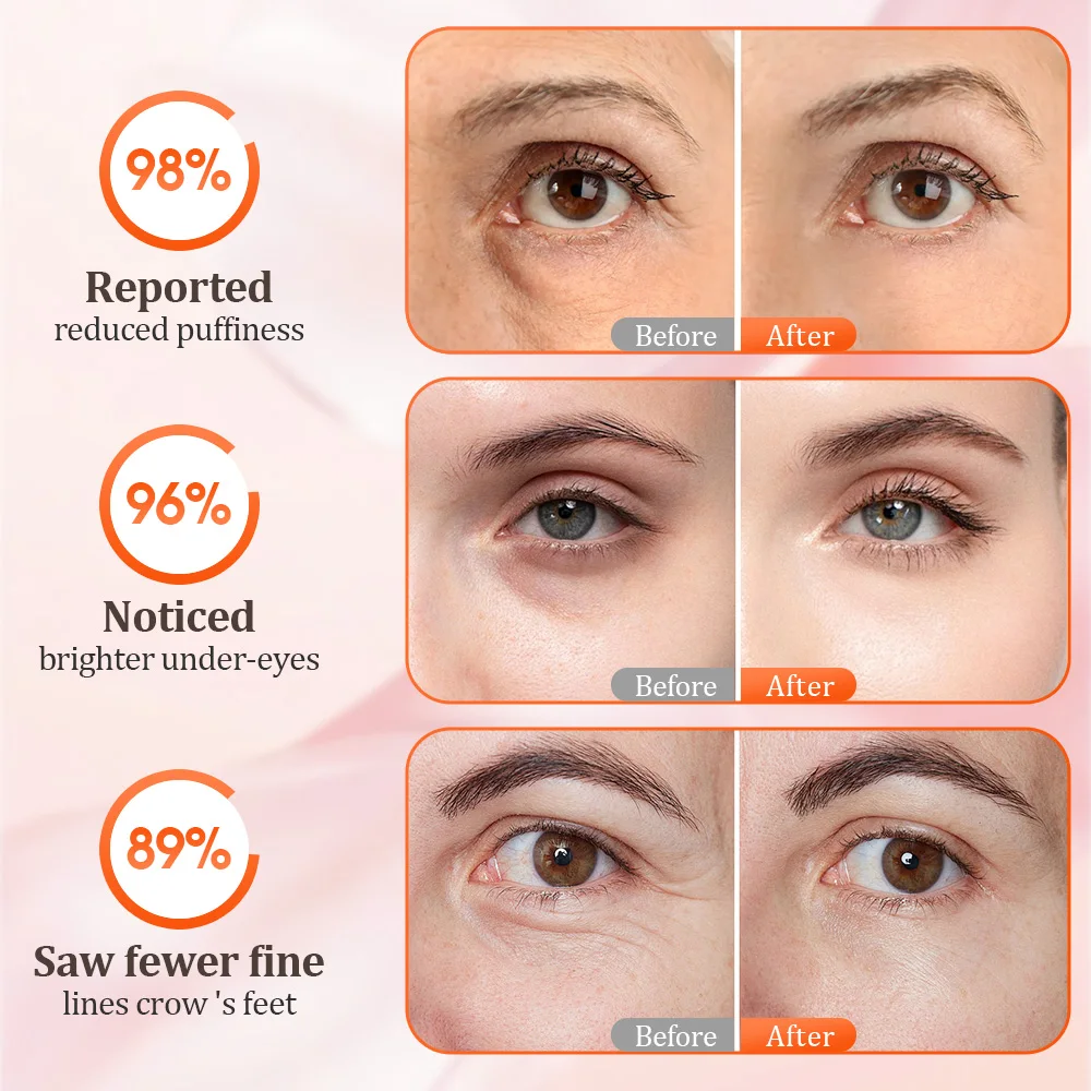 Appareil de thérapie par la lumière rouge pour les yeux, masseur oculaire 3D, Modes de microcourant 580-650nm, soulagement de la Fatigue, éclaircit les cernes, beauté, soins oculaires