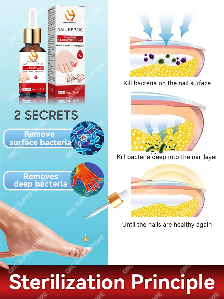 เซรั่มเท้าด้วยน้ํามันหอมระเหย onychomycosis ประสบการณ์การซ่อมแซม 7 วัน