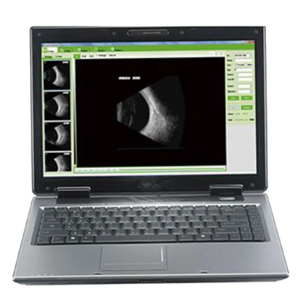 Hot Sale HO-200 A / B Ophthalmic LED Ultrasound Scanner for Biometry Eye Test in Ophthalmology