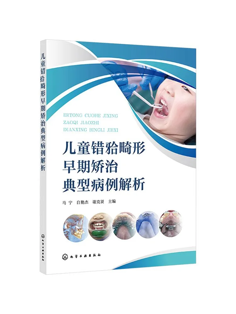 Book-Winshare Children's Mistake?analysis Of Typical Cases Of Early Orthodontic Treatment Of Deformities