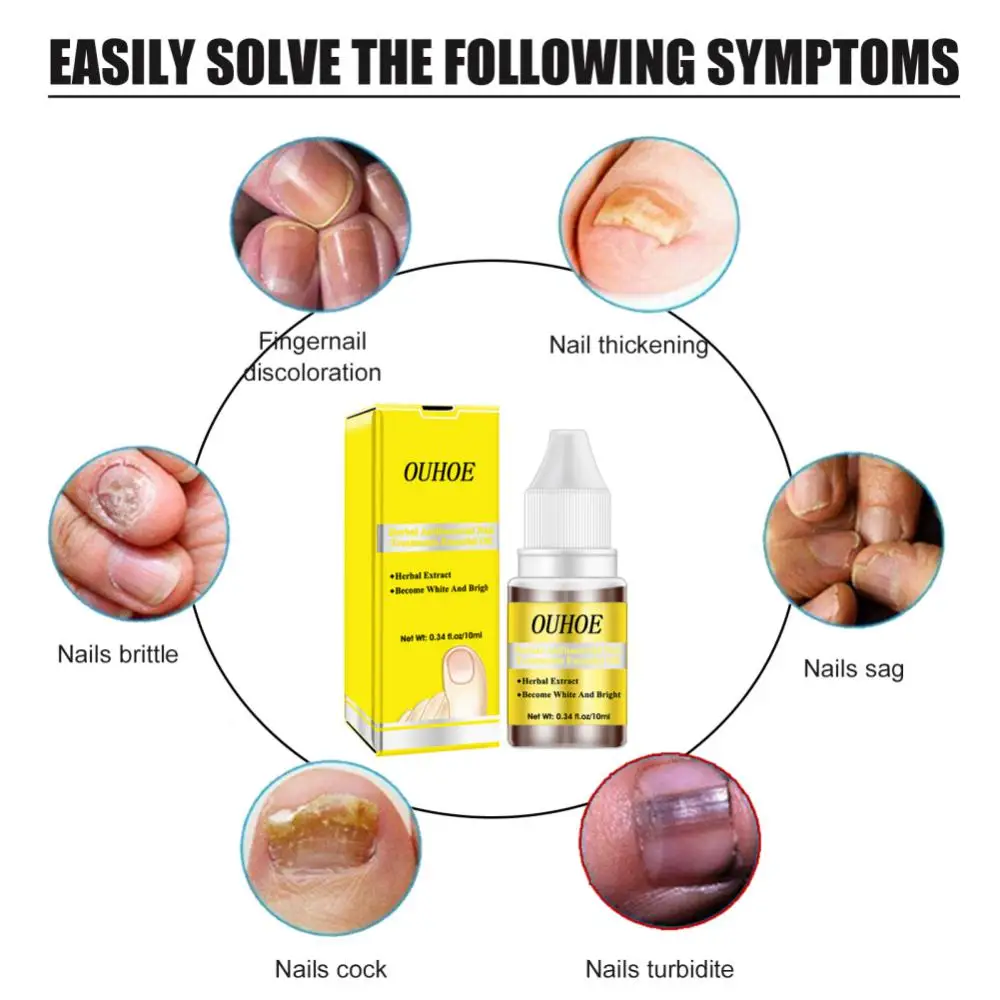 New Nail Fungal Treatments Feet Care Essencial Foot Repair Nail Fungus Removal Serum Gel Anti Infective Paronychia Onychomycosis